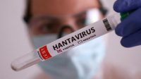 hantavirus2x