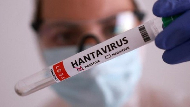 hantavirus2x
