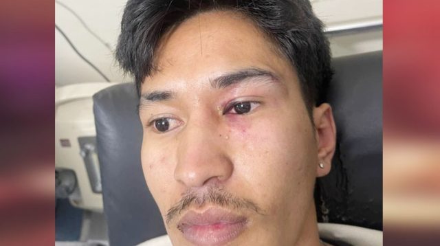 korban pukul
